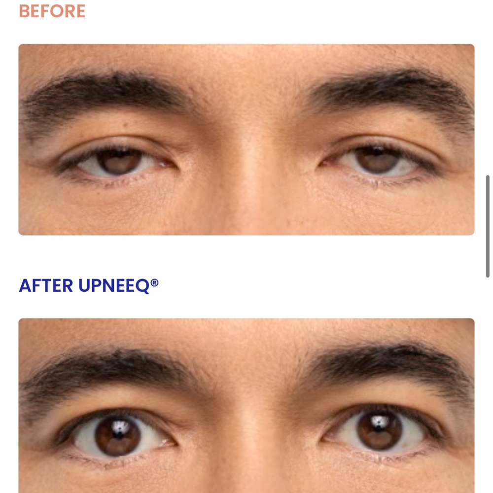UPNEEQ Eye Drops - set of 2 - Picture 4 of 7